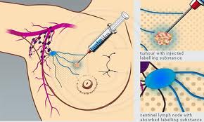 Lymphatic System